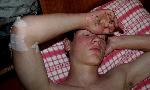 Jak se pojistit před cestou Jak se pojistit před cestou