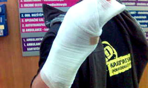 Nová tvář Horydoly Nová tvář Horydoly