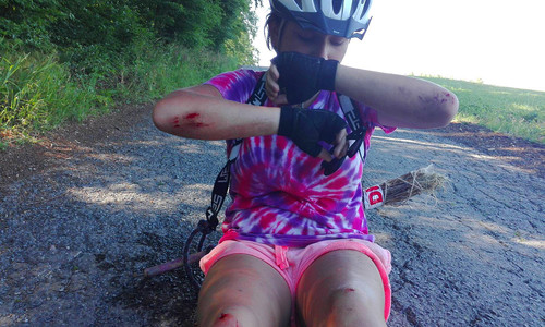 Pád z koloběžky: Odřeniny nebo těžké zranění? Pád z koloběžky: Odřeniny nebo těžké zranění?